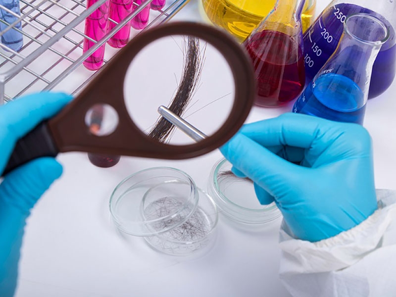 Examen Toxicologique